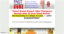 Desktop Screenshot of howtocuretonsilstones.com