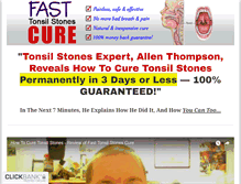 Tablet Screenshot of howtocuretonsilstones.com